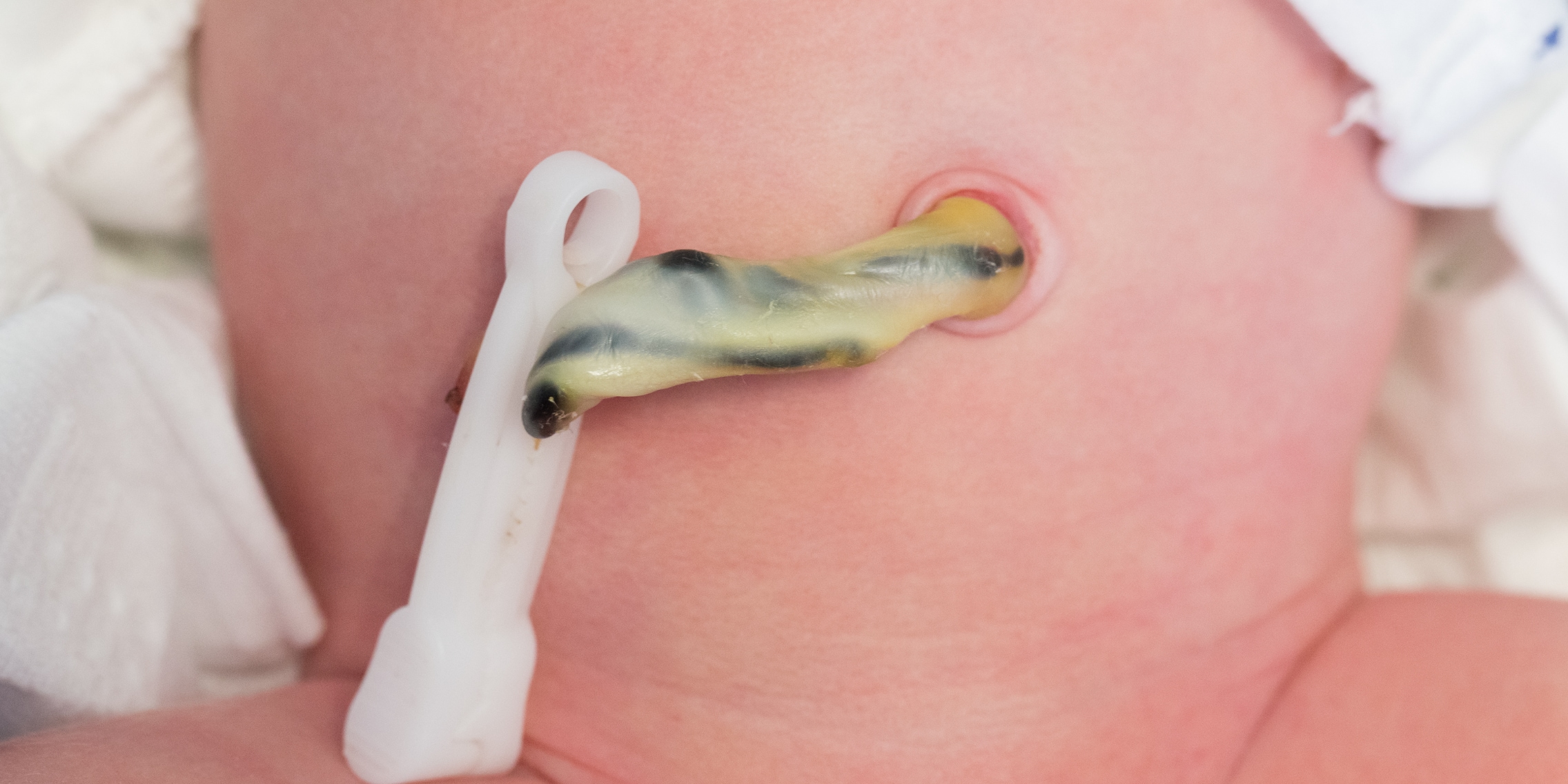 Scatola Porta Cordone Ombelicale – Custodia Ricordo Per Neonato, In Legno O Metallo, Per Conservare Il Cordone Ombelicale Come Ricordo Di Nascita