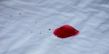 Le macchie di sangue sono un grosso problema soprattutto sui materiali chiari.