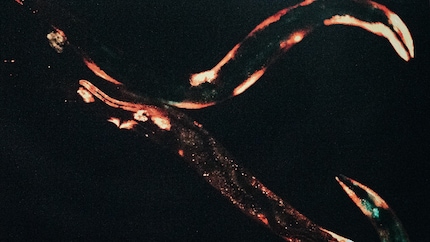 Un nematoda allo scanner.
