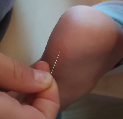 Un colpetto alla vescica, un piccolo cerotto e siamo pronti a partire.