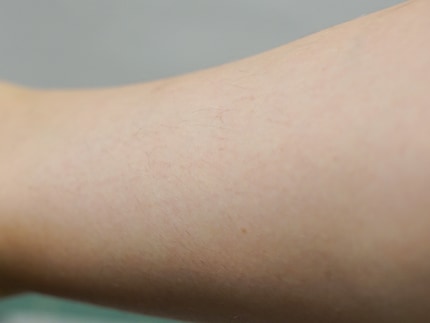 How my skin looked before…
