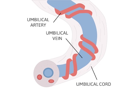 All'interno del cordone ombelicale, due arterie si avvolgono a spirale attorno a una vena