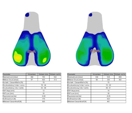 Visualizzazione della differenza di pressione dopo il fitting.