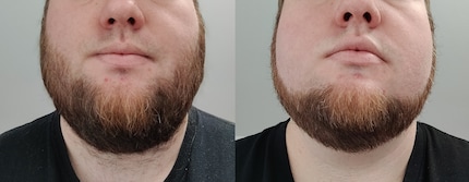 Before and after: not perfect – I had to go over the front left again – but I’m happy.