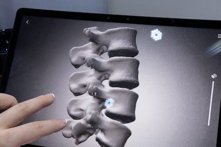 Il nubia Pad 3D II ha una visualizzazione 3D migliorata, ad esempio per i modelli ossei.