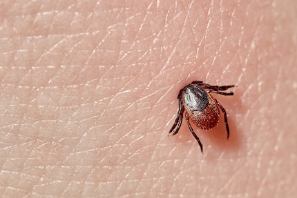 First the tick tears open your skin, then it stings the wound with its proboscis. Proceeding to gorge itself.
