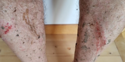 Orribile essere maltrattati dai propri pedali.