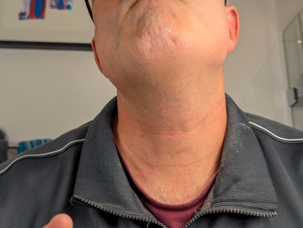 I hardly notice any skin irritation after shaving.