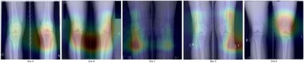 Although the AI’s supposed to use these X-ray images to identify whether the patient is a beer drinker, it’s actually deriving its results from other factors.