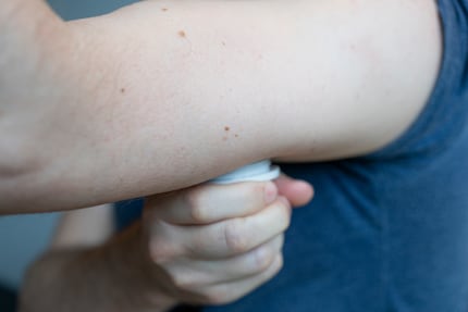Res applies gentle pressure to attach the sensor to his upper arm.