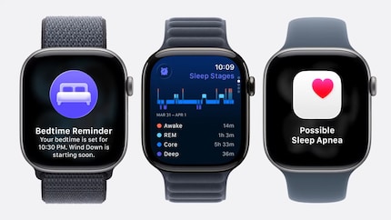 This is the Apple Watch 11.